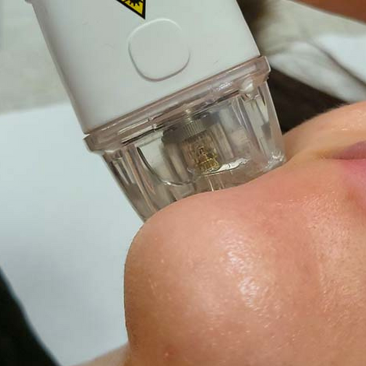 Face Lifting