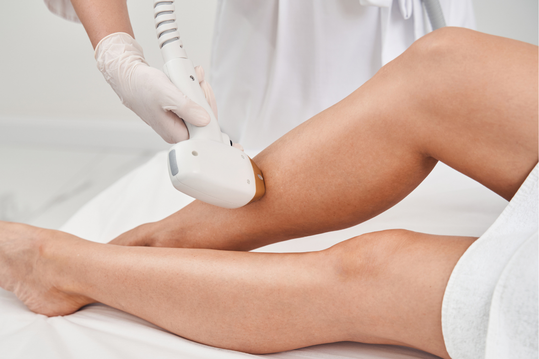 cura della pelle dopo epilazione laser a Padova