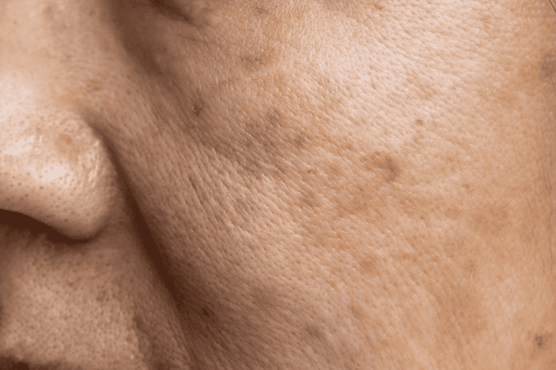 Macchie cutanee del viso valutate durante una consulenza viso personalizzata