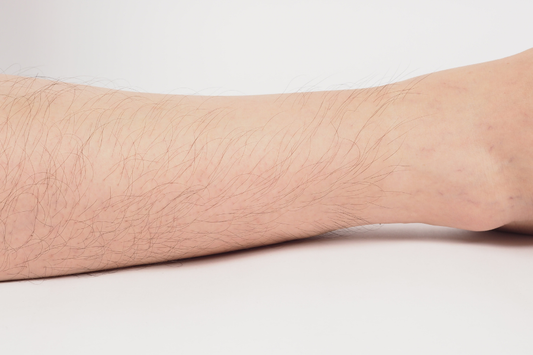 Perché alcune persone non vedono risultati con l’epilazione laser (e come evitarlo)