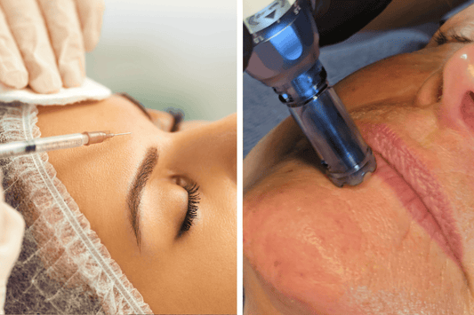 Filler o Microneedling? Come scegliere il trattamento viso migliore per te