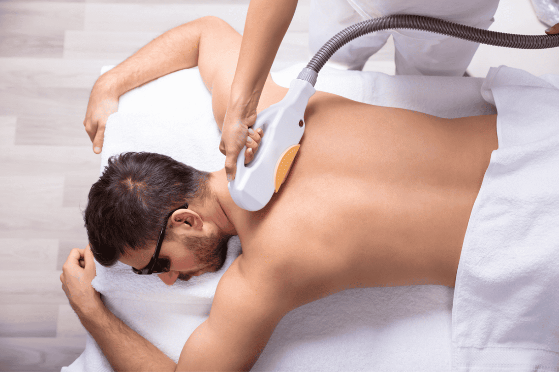 Epilazione laser per uomo a Padova e Piove: schiena, petto, inguine, zone più richieste, funzionamento e consulenza