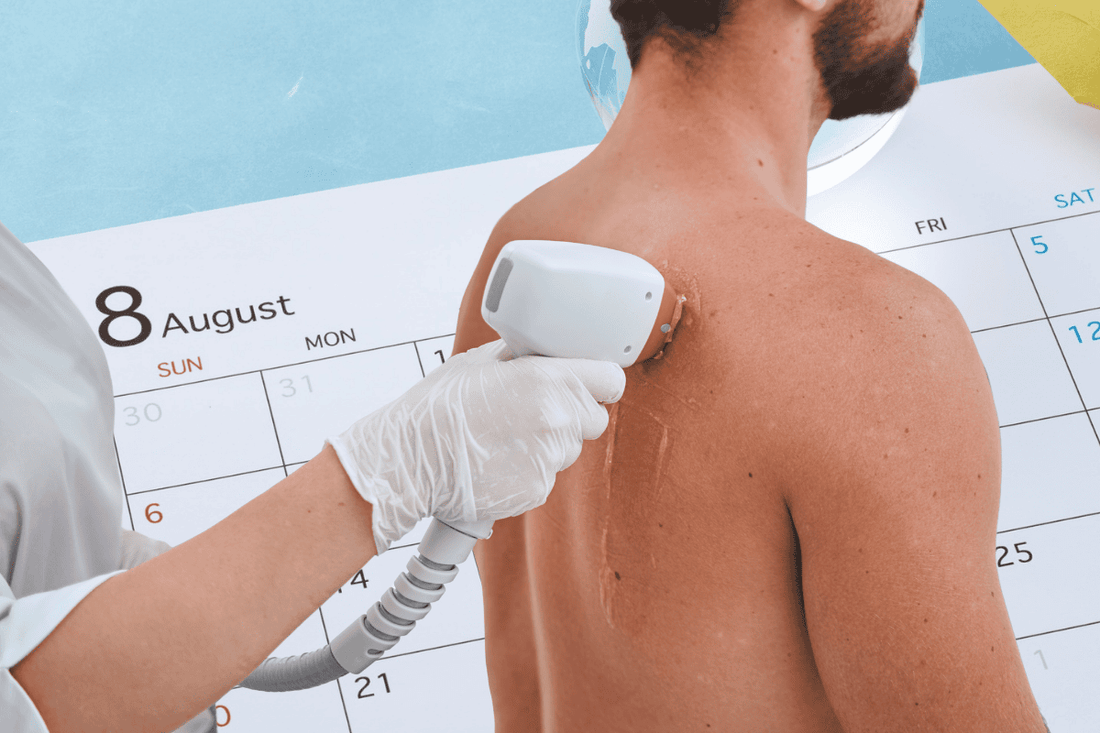 Epilazione laser d'estate Padova e Piove: quando si può fare, precauzioni necessarie, protezione solare e quando aspettare settembre"